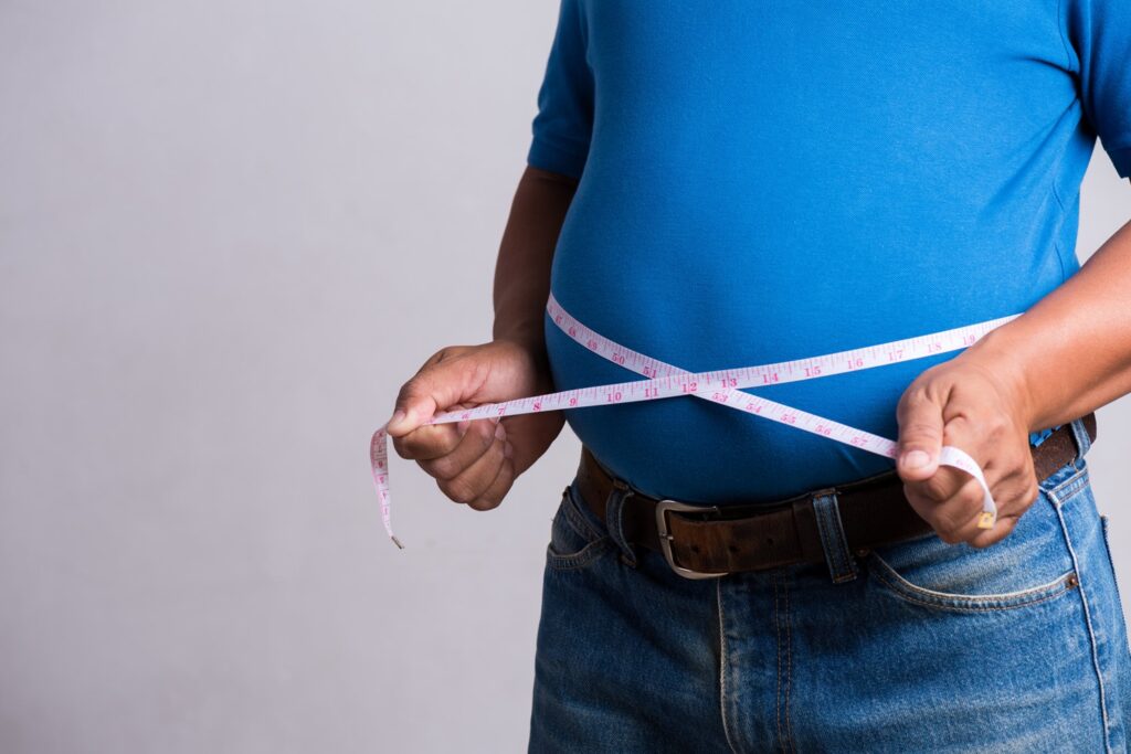 Obesity: What You Need to Know About this Lifestyle Disorder